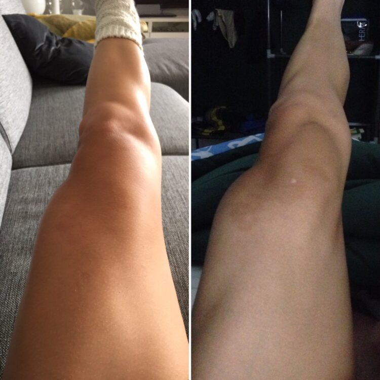 emma johansson feet 5