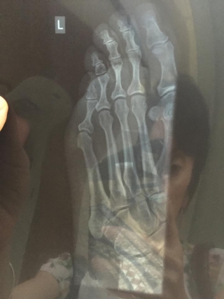 emma sutherland feet 5