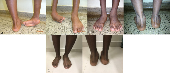 erika queiroz feet 3