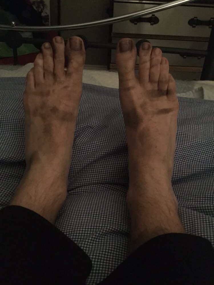 eugene feet