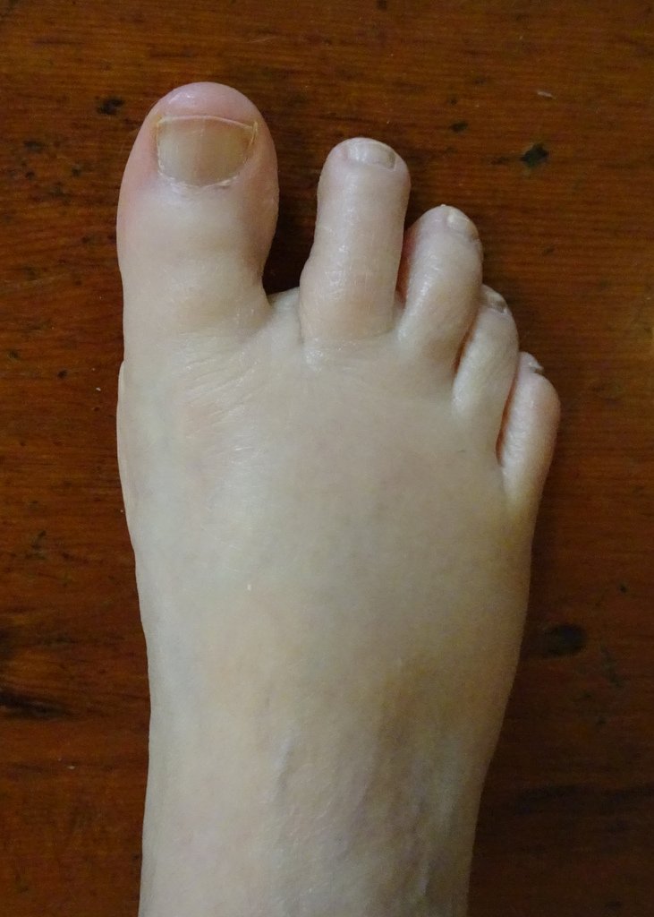 evelyn glennie feet 4