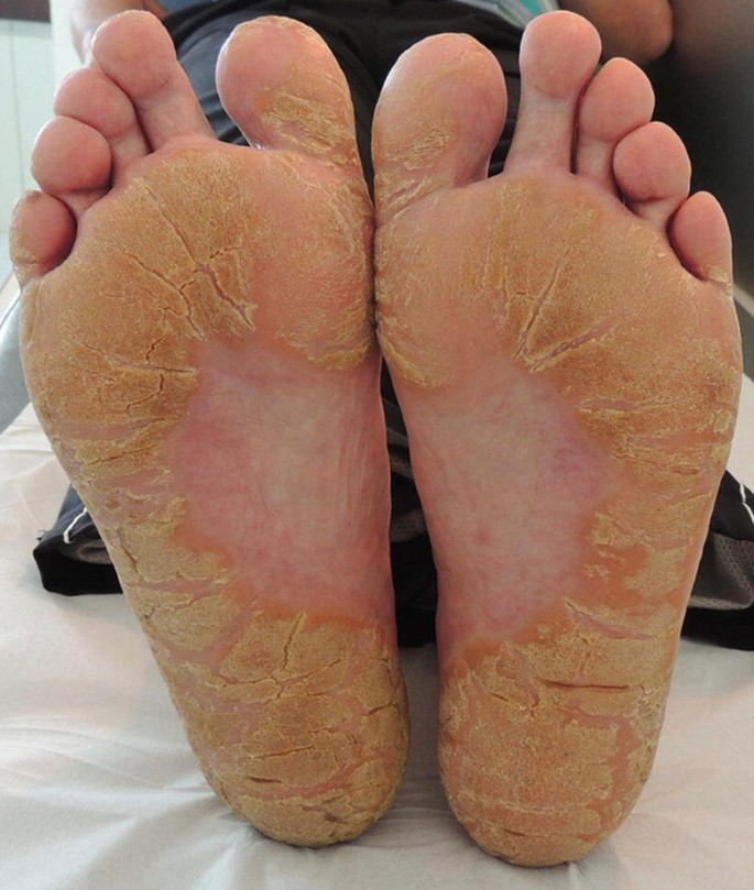 fa orozco feet 6