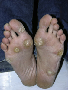 fabbi lee feet 3