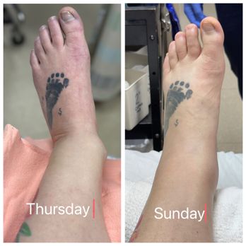 faye singleton feet 2