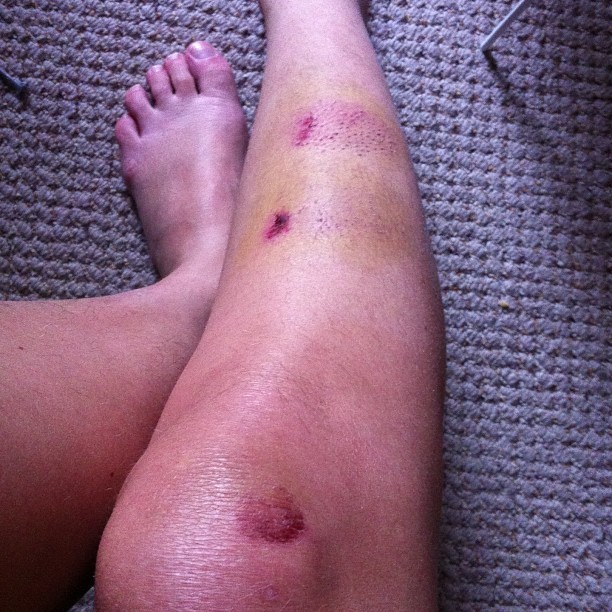 felicity ward feet 4