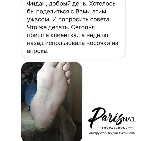 fidan huseynova feet 2