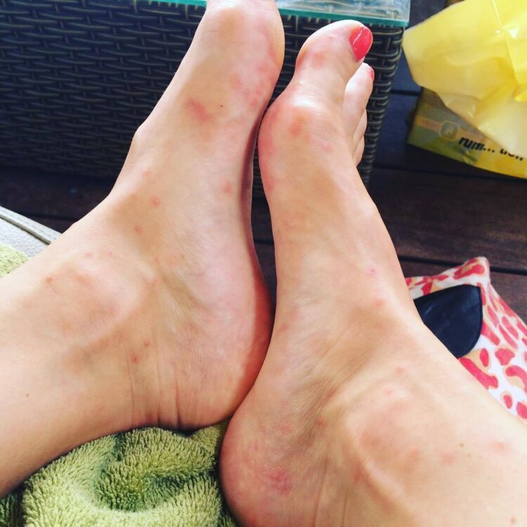 fockeline ouwerkerk feet 3