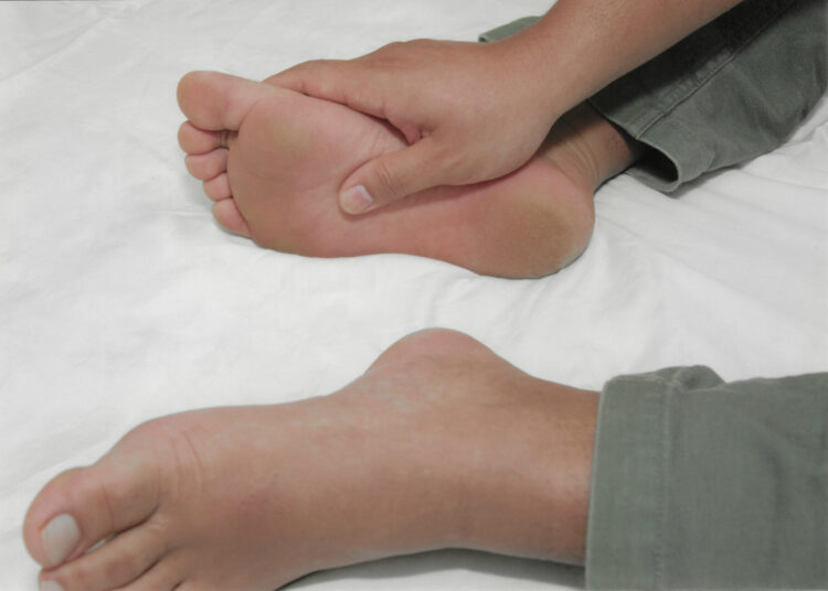 foodie friend amanda feet 2