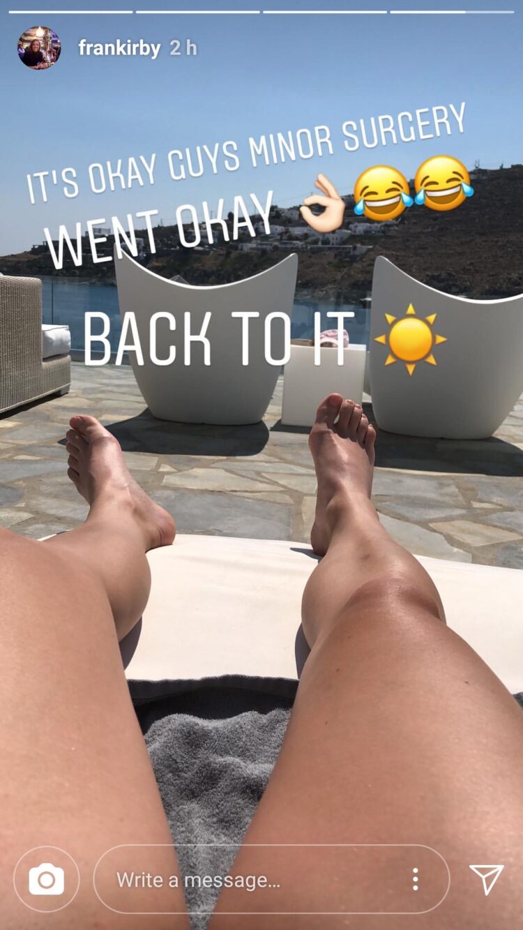 fran kirby feet 3