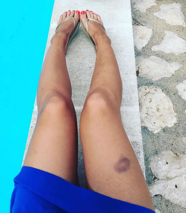 frances lefebure feet 2