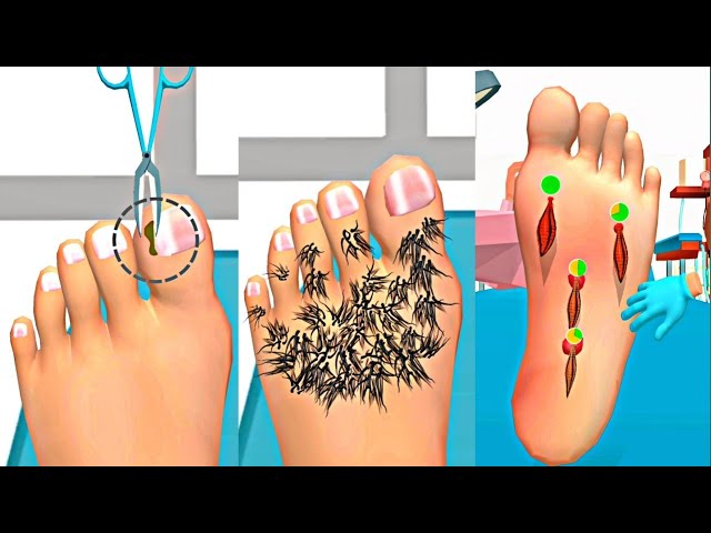 freckles asmr feet 4