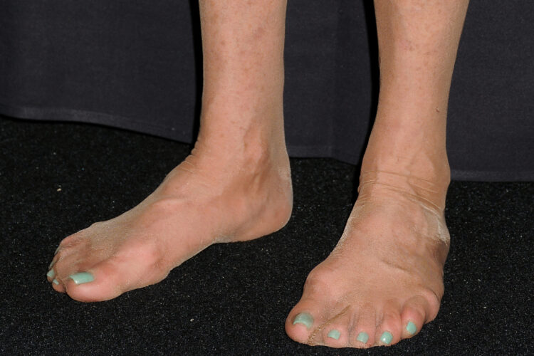 g0ldie feet 1 scaled