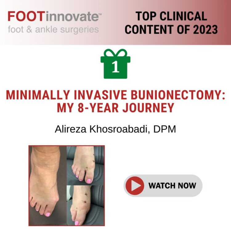 gabriela mendez feet 1