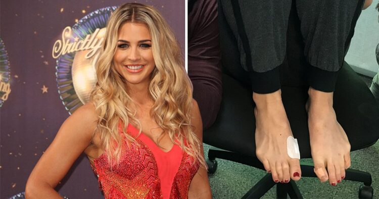 gemma atkinson feet 4