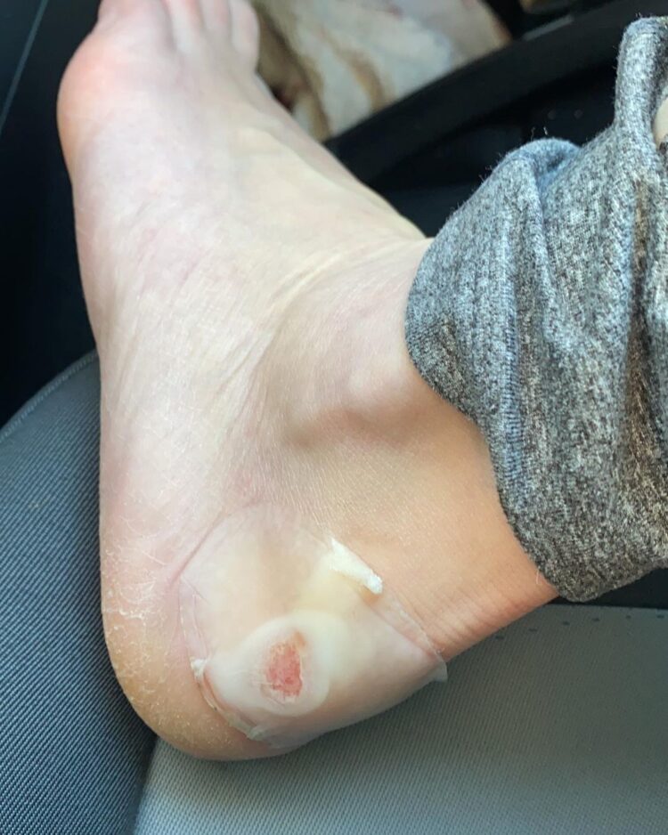 geraldine kemper feet 2