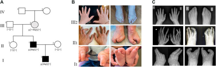 germina preses feet 6