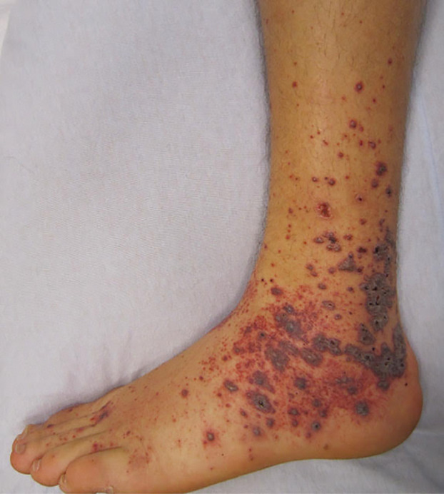 gio freitas santos feet 1