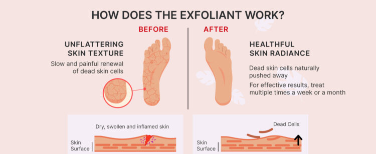 groove delight feet 5