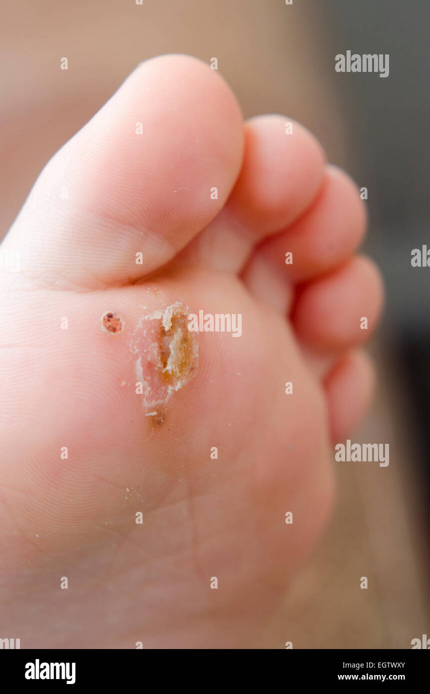 gukang feet 6