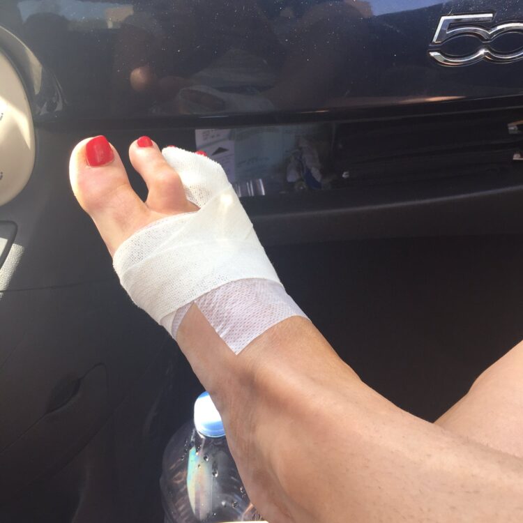 hannah hospital feet 4