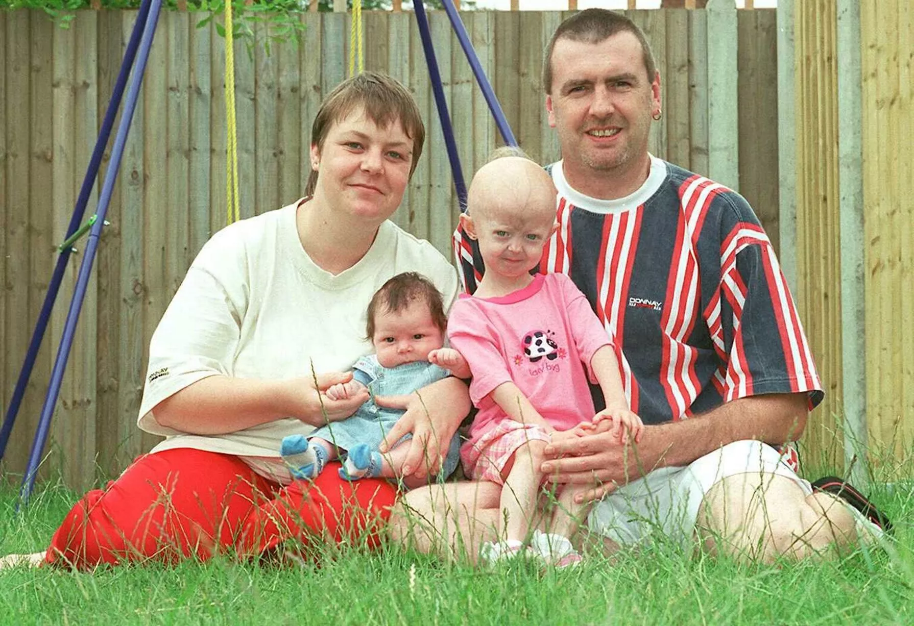 hayley okines feet 6