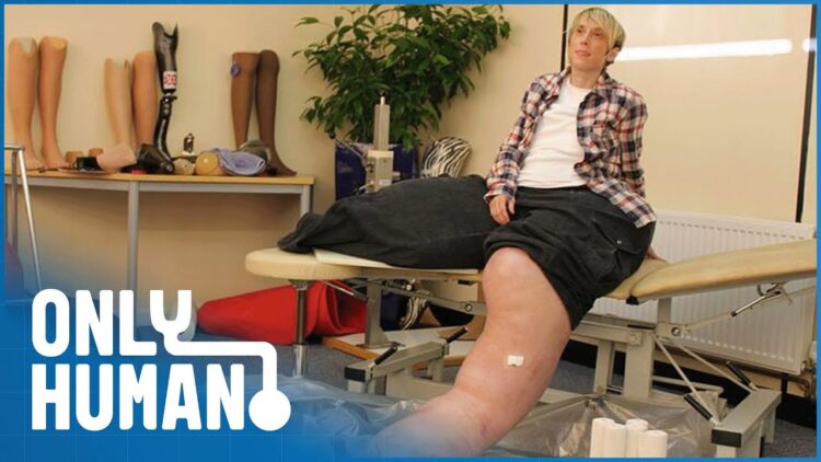 healthy mandy feet 4