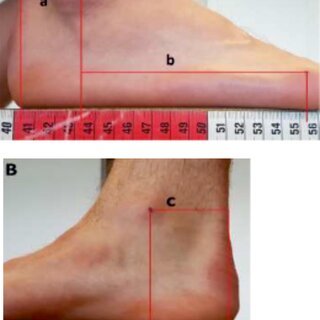 heidi dalsgaard sorensen feet 6