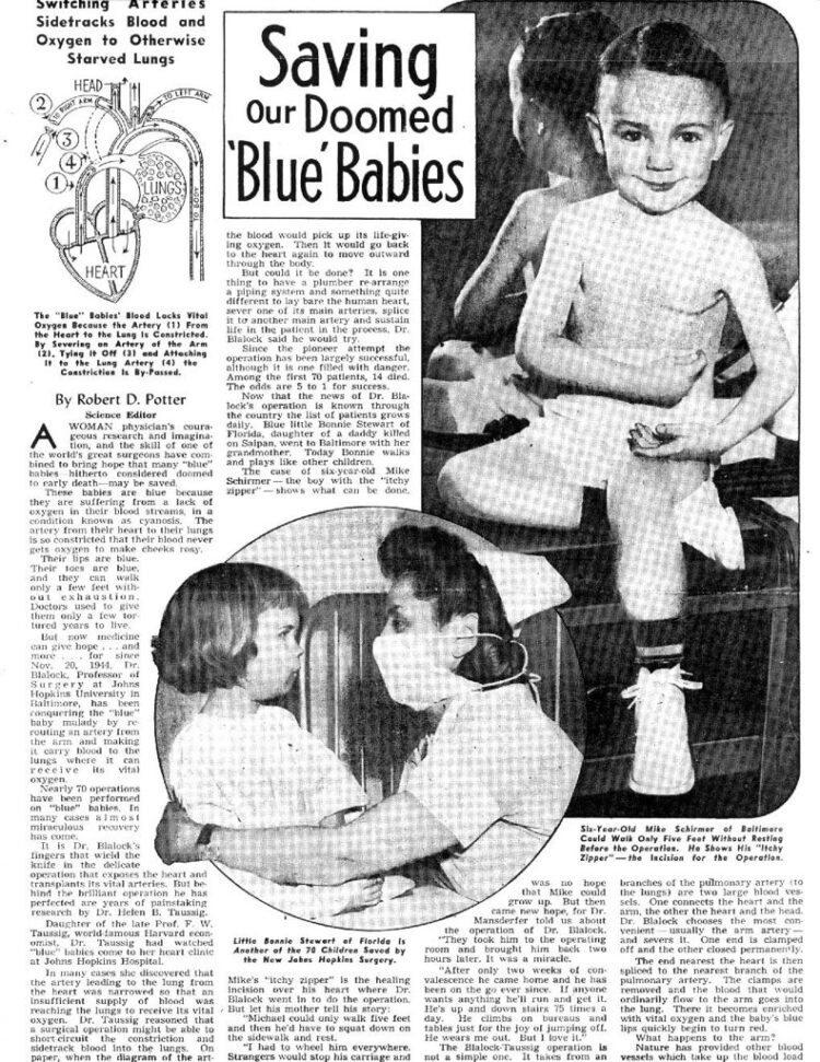 helen b. taussig feet 1