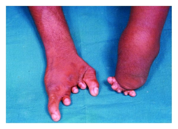 helena massaro feet 4