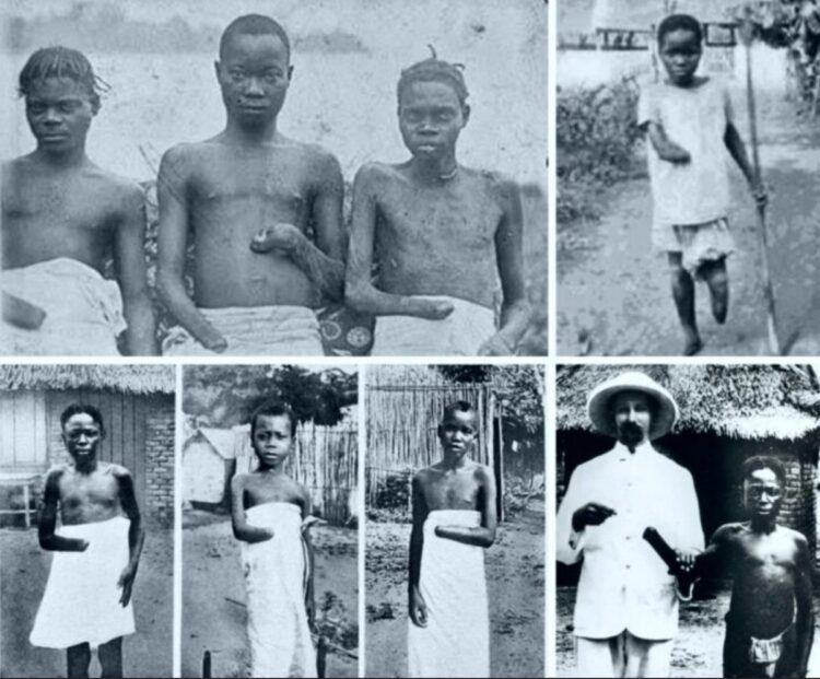 himynameisnoor feet 2