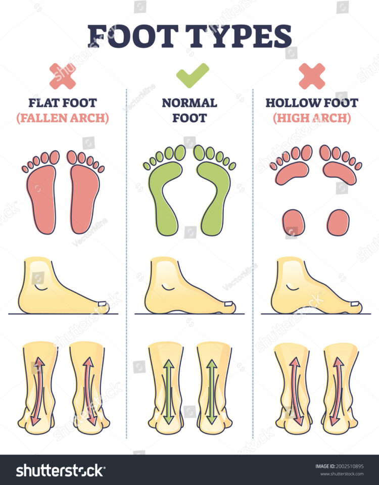 hollow feet 3