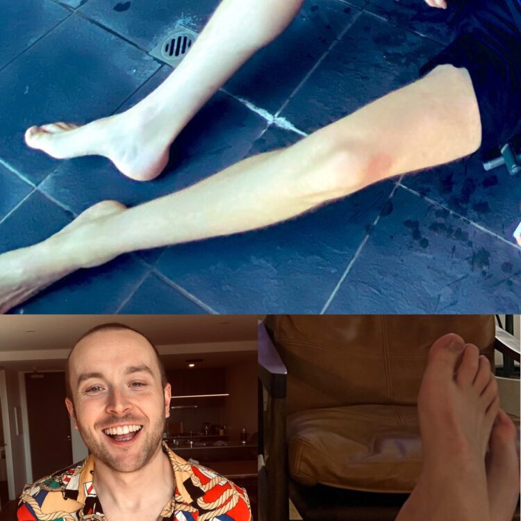 hunter smith feet 1