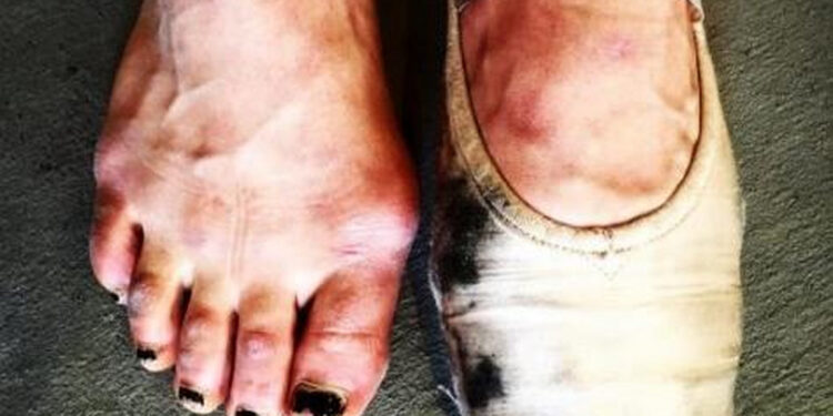 ida nowakowska herndon feet