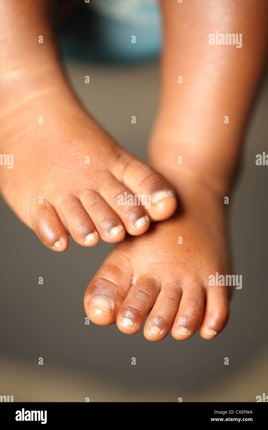 india baby feet 6