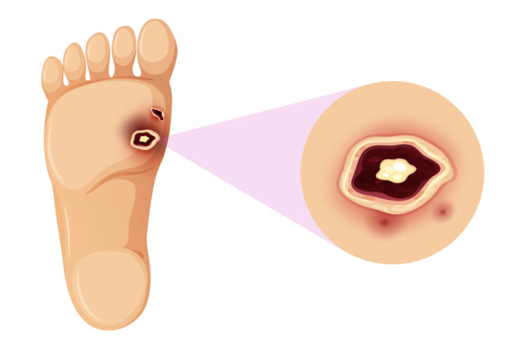 indias insights feet 6