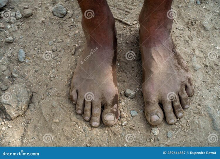 indii feet 1