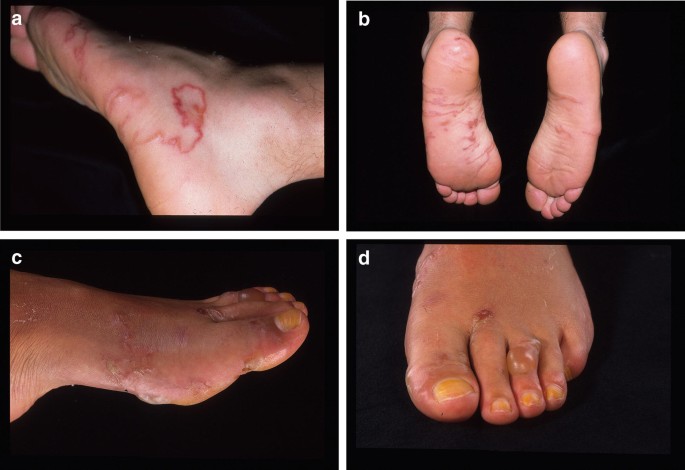 iris freitas araujo feet 1