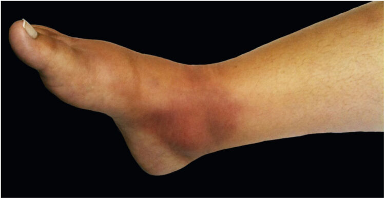 iris freitas araujo feet 6