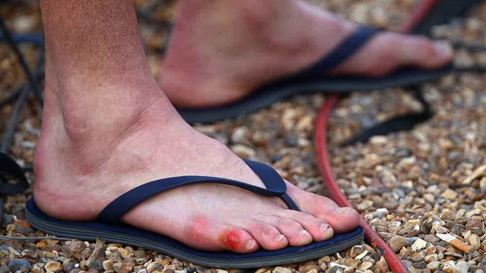 irm de bakker feet 5