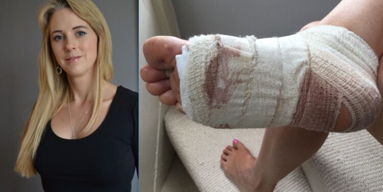 isabel oakeshott feet 1