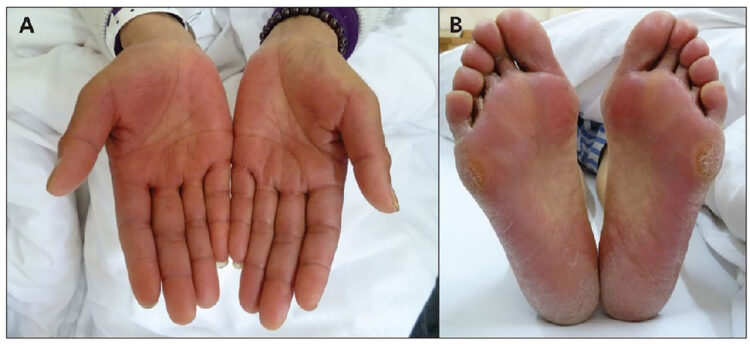 isabella bergamini feet 1 scaled