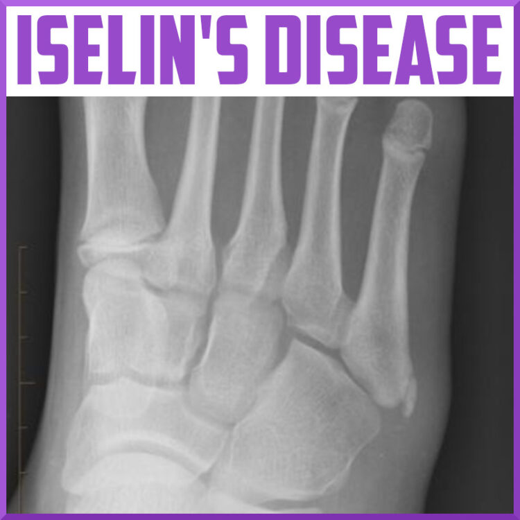 iselin martinsen feet 5