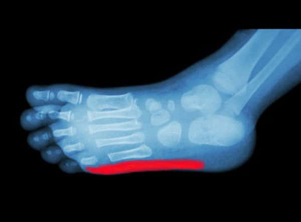 iselin martinsen feet