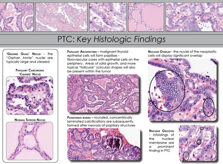 izzati zainal feet 6