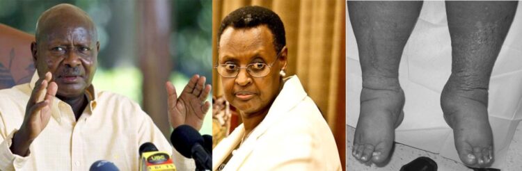 janet museveni feet 4