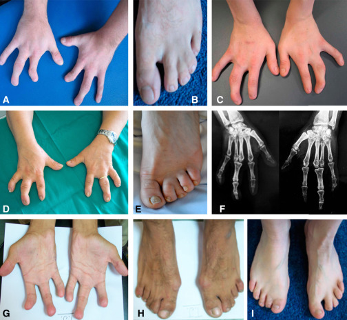 jbbouwmeester feet 1