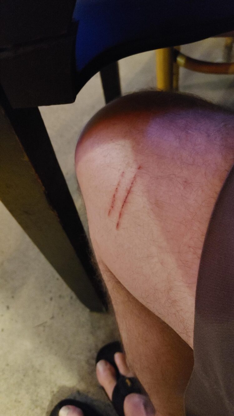 jean m. auel feet scaled