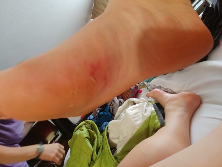 jessica fossey feet 3 scaled