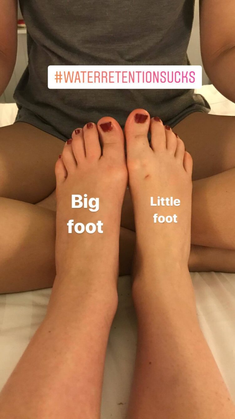 jessica kellgren fozard feet 4