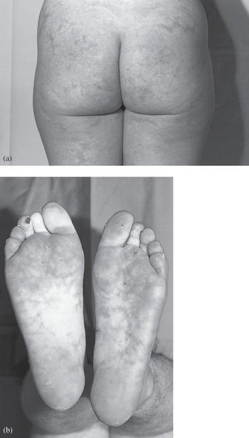 john h. striebel feet 3